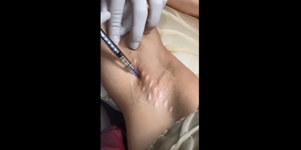 Load video: 